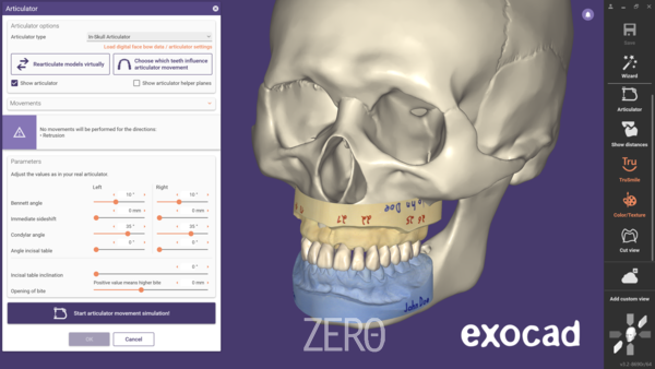 가상 교합기는 Gamma Dental Reference SL, Kavo PROTARevo 5B에 대한 새로운 지원과 해부학적 'in-skull' 교합기를 포함하고 있다. (출처: exocad)
